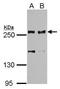 Scribble antibody, GTX107692, GeneTex, Western Blot image 