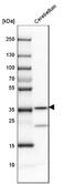 Carbonic Anhydrase 8 antibody, NBP1-86654, Novus Biologicals, Western Blot image 
