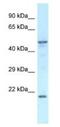 Protein Zfp113 antibody, NBP1-91373, Novus Biologicals, Western Blot image 