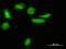 Low Density Lipoprotein Receptor Adaptor Protein 1 antibody, LS-B4523, Lifespan Biosciences, Immunofluorescence image 