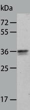 Annexin A8 antibody, TA323337, Origene, Western Blot image 