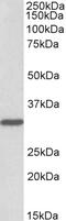 Uromodulin antibody, 43-157, ProSci, Enzyme Linked Immunosorbent Assay image 