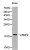 Vesicle Associated Membrane Protein 2 antibody, LS-C192512, Lifespan Biosciences, Western Blot image 