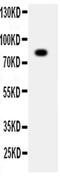 ADAM Metallopeptidase Domain 2 antibody, PA5-78725, Invitrogen Antibodies, Western Blot image 