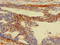 Ribosomal Protein S5 antibody, LS-C679358, Lifespan Biosciences, Immunohistochemistry paraffin image 