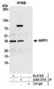 WAS/WASL Interacting Protein Family Member 1 antibody, A305-377A, Bethyl Labs, Immunoprecipitation image 