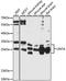 Lin-7 Homolog A, Crumbs Cell Polarity Complex Component antibody, LS-C750314, Lifespan Biosciences, Western Blot image 