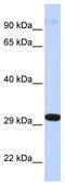 Zinc Finger Protein 688 antibody, TA332253, Origene, Western Blot image 