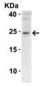 Suppressor Of Cytokine Signaling 1 antibody, 3767, ProSci Inc, Western Blot image 