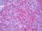 Histone Deacetylase 7 antibody, orb95732, Biorbyt, Immunohistochemistry paraffin image 