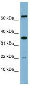 RWD Domain Containing 1 antibody, TA345063, Origene, Western Blot image 