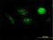 Aurora kinase A-interacting protein antibody, H00054998-B01P, Novus Biologicals, Immunofluorescence image 