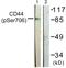 CD44 antibody, TA311790, Origene, Western Blot image 