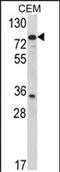 Transglutaminase 4 antibody, PA5-72495, Invitrogen Antibodies, Western Blot image 