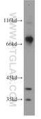 Bardet-Biedl Syndrome 7 antibody, 18961-1-AP, Proteintech Group, Western Blot image 