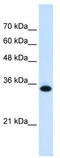 Solute Carrier Family 25 Member 38 antibody, TA333765, Origene, Western Blot image 