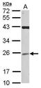 Ubiquitin Conjugating Enzyme E2 F (Putative) antibody, GTX118584, GeneTex, Western Blot image 