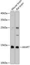 A-Kinase Anchoring Protein 7 antibody, A07387, Boster Biological Technology, Western Blot image 