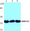 Aldo-Keto Reductase Family 1 Member A1 antibody, A04855, Boster Biological Technology, Western Blot image 