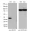 Glyoxylate And Hydroxypyruvate Reductase antibody, GTX84415, GeneTex, Western Blot image 