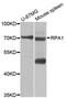 Replication Protein A1 antibody, MBS128003, MyBioSource, Western Blot image 