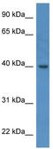 ELMO domain-containing protein 3 antibody, TA342950, Origene, Western Blot image 