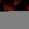 Katanin p60 ATPase-containing subunit A1 antibody, HPA036207, Atlas Antibodies, Immunocytochemistry image 
