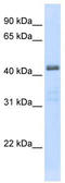 Solute Carrier Family 29 Member 2 antibody, TA334057, Origene, Western Blot image 
