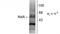 Retinoic Acid Receptor Alpha antibody, TA309229, Origene, Western Blot image 