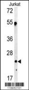Complement C1q A Chain antibody, 62-823, ProSci, Western Blot image 