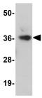 Leucine Rich Repeat Containing 19 antibody, GTX85200, GeneTex, Western Blot image 