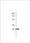 Homeobox protein Dlx6a antibody, PA5-72622, Invitrogen Antibodies, Western Blot image 