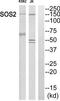 SOS Ras/Rho Guanine Nucleotide Exchange Factor 2 antibody, TA314554, Origene, Western Blot image 