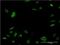 Nex1 antibody, H00063974-M06, Novus Biologicals, Immunocytochemistry image 