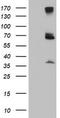 Proteasome 26S Subunit, Non-ATPase 3 antibody, TA504337, Origene, Western Blot image 