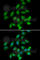 Protein Phosphatase 2 Catalytic Subunit Alpha antibody, A6702, ABclonal Technology, Immunofluorescence image 
