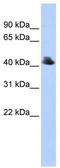 F-Box Protein 4 antibody, TA329824, Origene, Western Blot image 
