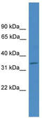 ELMO Domain Containing 1 antibody, TA344840, Origene, Western Blot image 