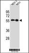 SRC Proto-Oncogene, Non-Receptor Tyrosine Kinase antibody, MBS9207912, MyBioSource, Western Blot image 