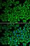 Interleukin 12 Receptor Subunit Beta 1 antibody, LS-C335191, Lifespan Biosciences, Immunofluorescence image 