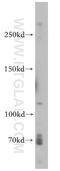 Von Willebrand Factor antibody, 11778-1-AP, Proteintech Group, Western Blot image 