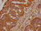 PRAME Family Member 18 antibody, CSB-PA018613LA01HU, Cusabio, Immunohistochemistry paraffin image 