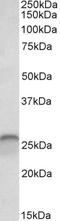 Malignant T cell-amplified sequence 1 antibody, 43-155, ProSci, Western Blot image 