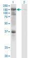 Ubiquitin carboxyl-terminal hydrolase 4 antibody, LS-C198411, Lifespan Biosciences, Western Blot image 