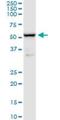 Beta-Secretase 1 antibody, H00023621-M01, Novus Biologicals, Western Blot image 
