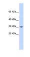 Potassium Calcium-Activated Channel Subfamily N Member 2 antibody, orb329833, Biorbyt, Western Blot image 