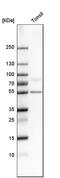 Ectonucleoside Triphosphate Diphosphohydrolase 1 antibody, HPA014067, Atlas Antibodies, Western Blot image 