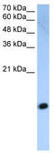 Histone Cluster 2 H2A Family Member C antibody, TA339214, Origene, Western Blot image 