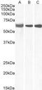 Ephrin A2 antibody, STJ70211, St John