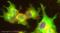 Gelsolin antibody, ab74420, Abcam, Immunofluorescence image 